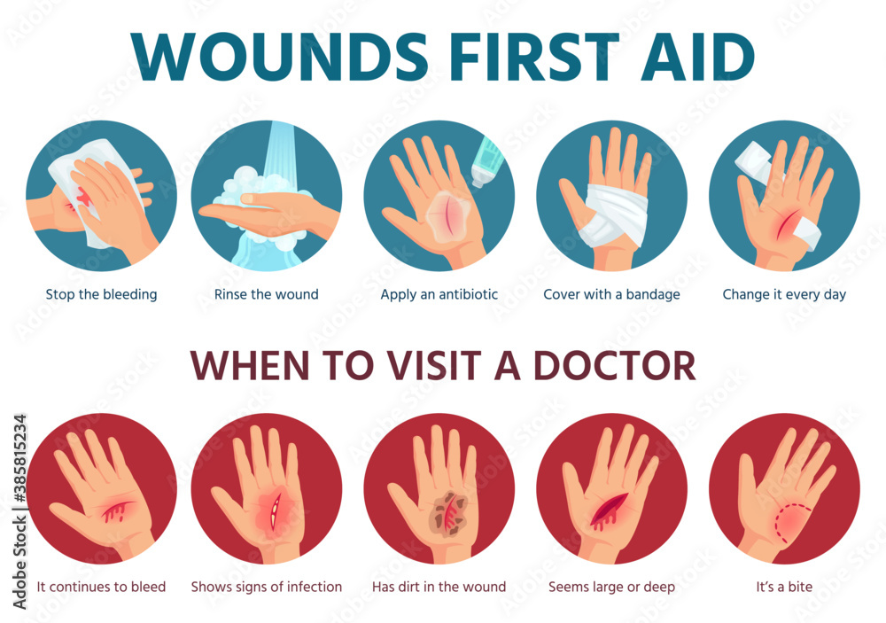 Vetor de First aid for wound on skin. Treatment procedure for bleeding ...