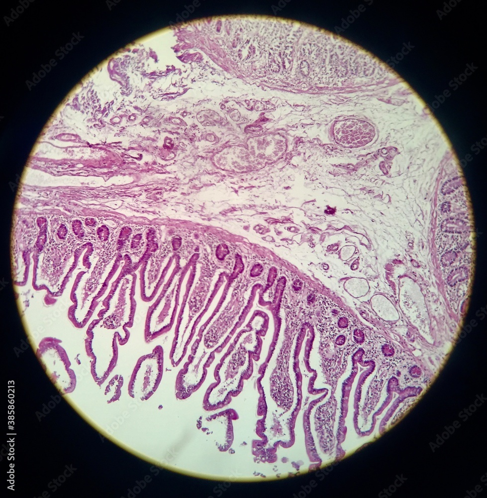 visión microscópica del intestino delgado visión microscópica del intestino delgado