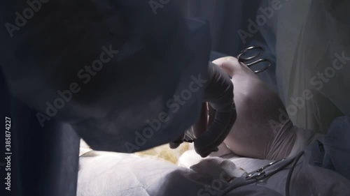 Close up of circumcision surgery on male penis. Action. Doctors are going to circumcise the foreskin of man genitals with medical equipment in operating room. photo