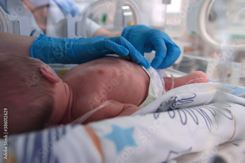 Nurse in blue gloves takes action to monitor and care for premature baby, selective focus. Newborn is placed in the incubator. Neonatal intensive care unit