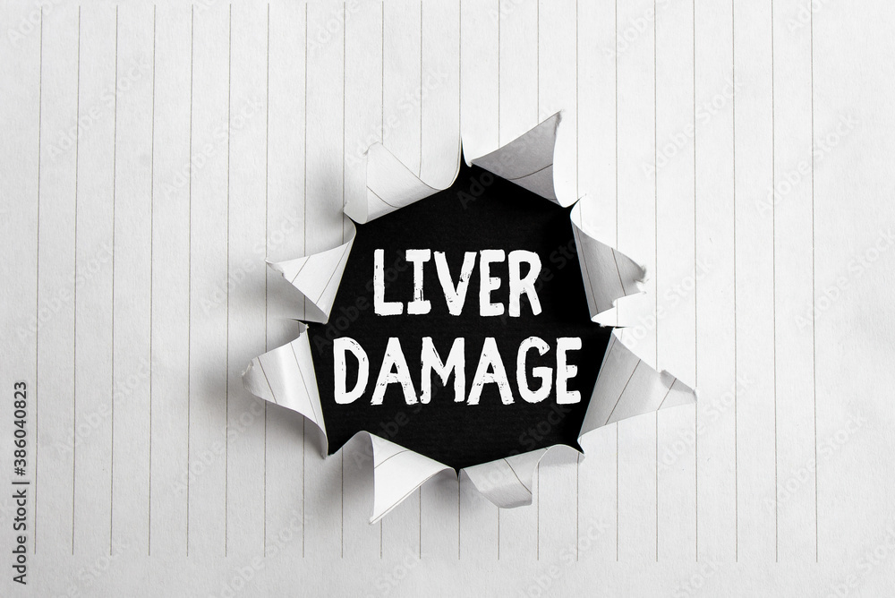 Conceptual hand writing showing Liver Damage. Concept meaning any