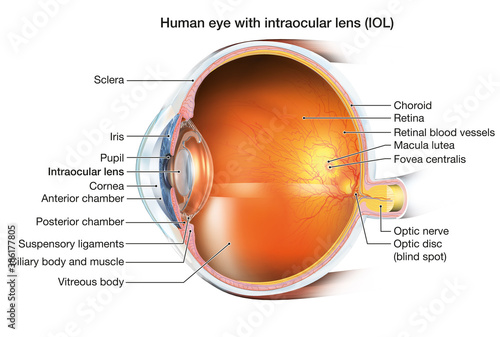 Human eye with intraocular lens (IOL), anatomy, medically 3D illustration