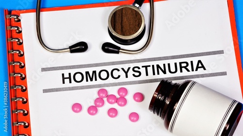 Homocystinuria is a hereditary metabolic defect. Text label for a medical diagnosis. Diagnosis by a doctor. Treatment with pills.