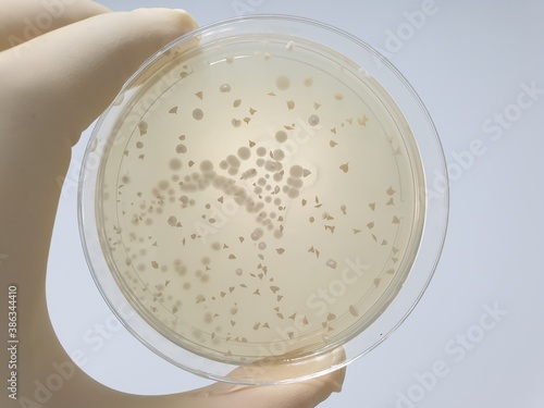 Konstfotografi Saccharomyces boulardii microbial culture results
