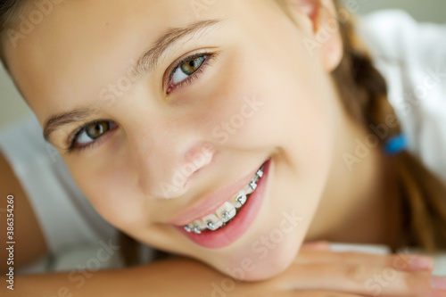 Close up portrait of smiling teenager girl showing dental braces.Isolated on white background. High quality photo.