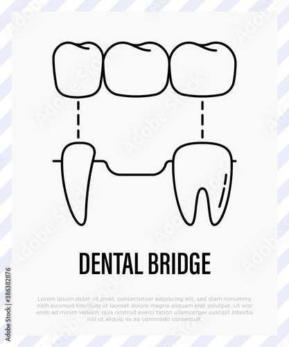 Dental bridge, tooth restoration. Dentistry, prosthesis. Thin line icon, vector illustration.
