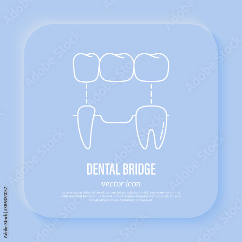 Dental bridge, tooth restoration. Dentistry, prosthesis. Thin line icon, vector illustration.