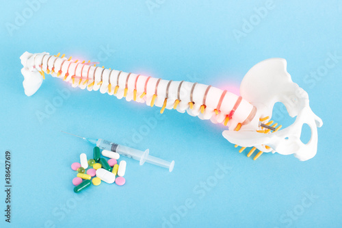 A model of the spine on a blue background near which there are pills and injections. Concept of treatment of degenerative diseases of the spine with drugs and pills, chondroprotectors and pain photo