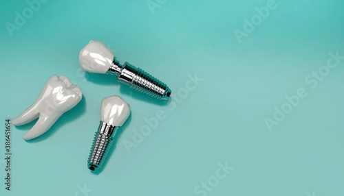 Close up tooth or dental implant human denture 3d illustration. Teeth root embed in jaw bone to support artificial crown. Anatomy concept on medical green background with copy space. 