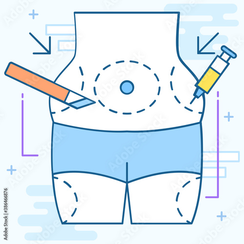 Liposuction 
