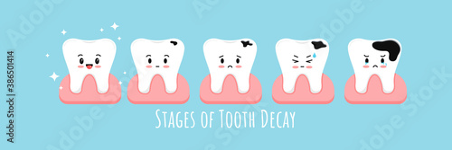 Stages of tooth decay in gum icon set. Cute kawaii teeth on different stages of dental caries development. Flat cartoon emoji character vector illustration. Kids dental hygiene and treatment concept.