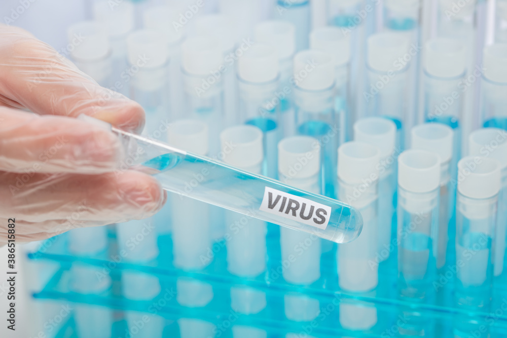 Close-up view of biological tubes with label virus. Concept of Coronavirus infection. Looking for vaccine. Laboratory room. Biological hazard. Healthcare. Close-up view of biological tubes with label virus. Concept of Coronavirus infection. Looking for vaccine. Laboratory room. Biological hazard. Healthcare.