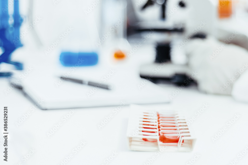 blurry image of a desktop in a medical laboratory.