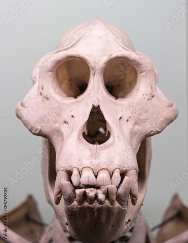 skull of the person