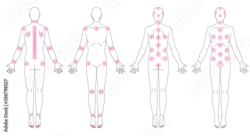 人体.痛みなどが出る場所.性別無しの略図.