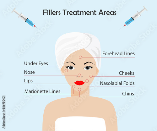 Dermal Fillers or botox Injection Treatment areas. Beautiful woman's face with red points show injection area. Idea for beauty plastic surgery, cosmetology, professional anti aging concept.
