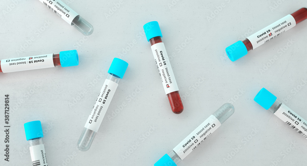 Test tubes filled with blood, testing in a laboratory for Covid-19 . Coronavirus medical screening. Blood samples in glass test tubes.  - obrazy, fototapety, plakaty 