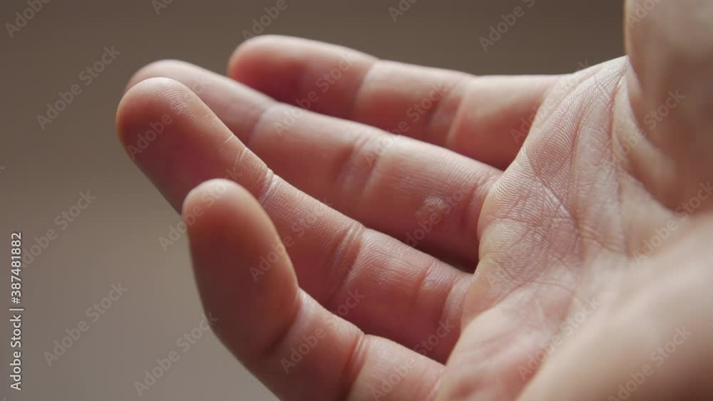 The skin lesions warts on hand closeup refocusing The skin lesions warts on hand closeup refocusing