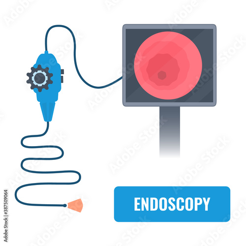 Endoscopy procedure equipment for stomach disease diagnostics. Gastrointestinal tract examination with endoscope. Medical concept. Vector illustration in flat style. 