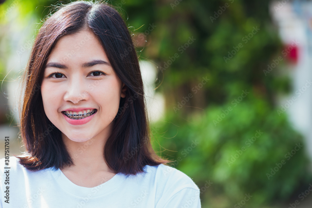 Portrait of Asian teen beautiful young woman smile have dental braces on teeth laughing outdoor, Medicine and dentistry concept Portrait of Asian teen beautiful young woman smile have dental braces on teeth laughing outdoor, Medicine and dentistry concept