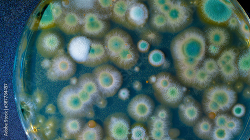 Tableau sur toile close up petri dish with microbe colony
