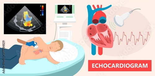 Cath Lab Atrial Septal Defect Tetralogy of Fallot Patent Foramen Ovale Mitral Valve Stenosis Heart Attack Ductus Arteriosus Doppler Coronary Artery Disease Congestive Congenital Valvular VSD exam leak