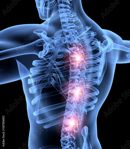 A problem with the spine