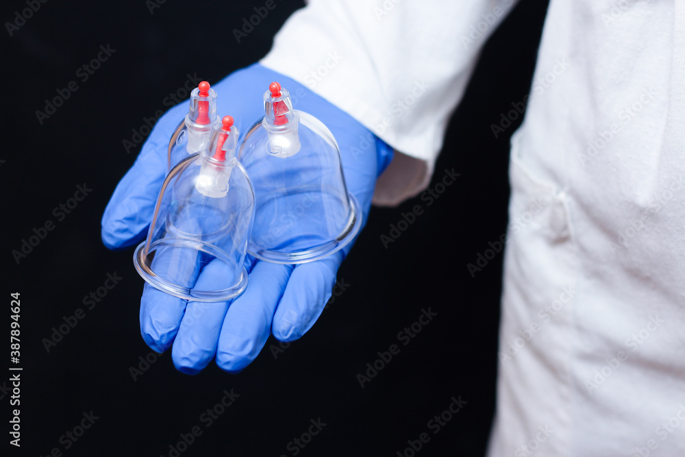Jars for hijama bloodletting in the hands of a doctor in a white coat on a black background. Hijama according to the Sunnah. Hajjam Jars for hijama bloodletting in the hands of a doctor in a white coat on a black background. Hijama according to the Sunnah. Hajjam