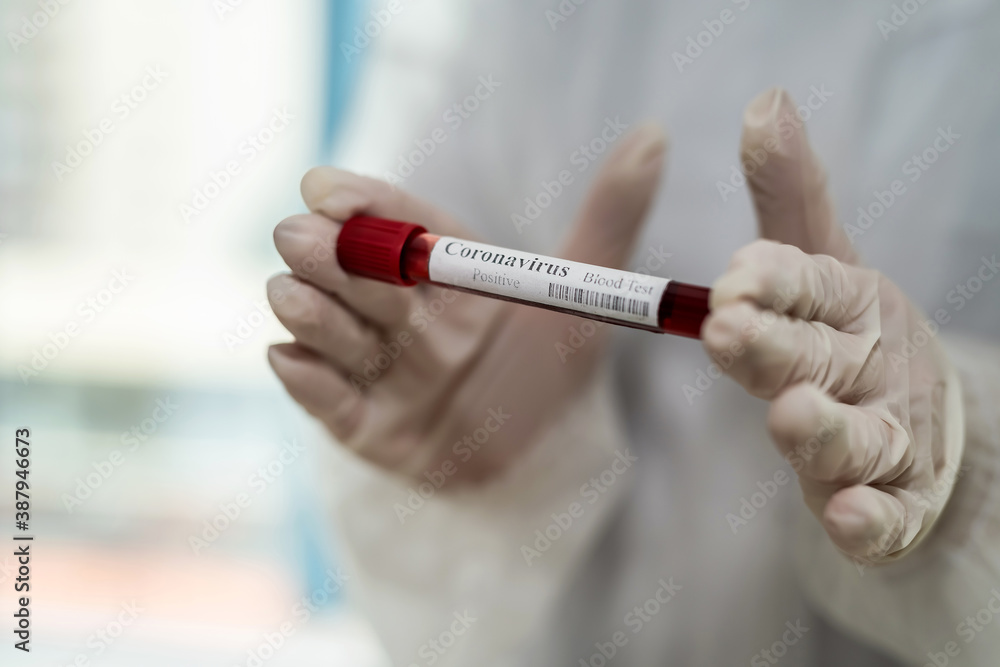 Fototapeta premium female hand hold test tube with blood sample for laboratory testing on analyzing Covid-19