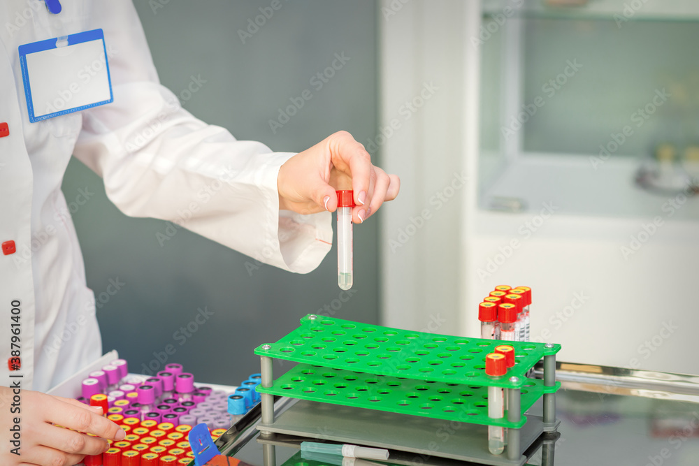 Hand of lab technician or nurse takes empty blood test tube from rack in the research laboratory