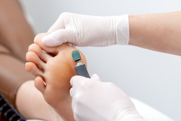 Handdoek met foto Pedicure Eeltverwijdering tijdens professionele pedicure  © okskukuruza