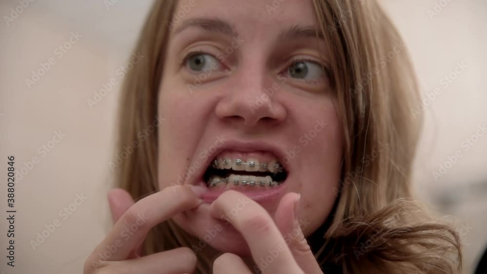 Woman examines teeth with braces. Teeth hygiene concept Woman examines teeth with braces. Teeth hygiene concept