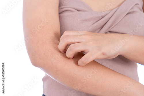 Female scratching her arm isolated white background. Medical, healthcare for advertising concept. photo