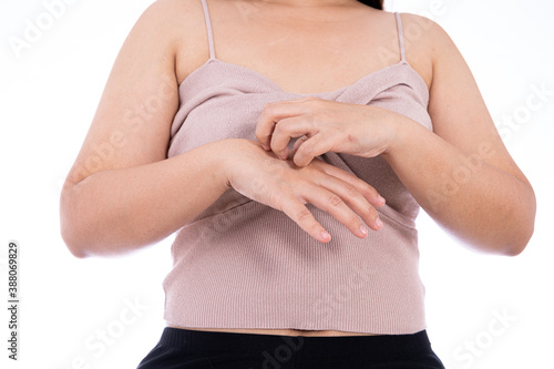 Female scratching her hand isolated white background. Medical, healthcare for advertising concept. photo