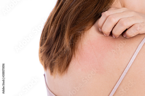 Female scratching her back isolated white background. Medical, healthcare for advertising concept. photo