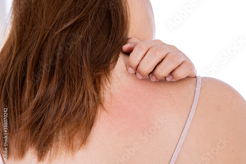 Female scratching her back isolated white background. Medical, healthcare for advertising concept. photo