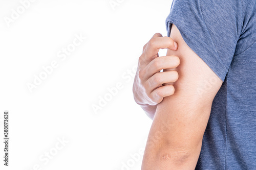 Male scratching his arm isolated white background. Medical, healthcare for advertising concept. photo
