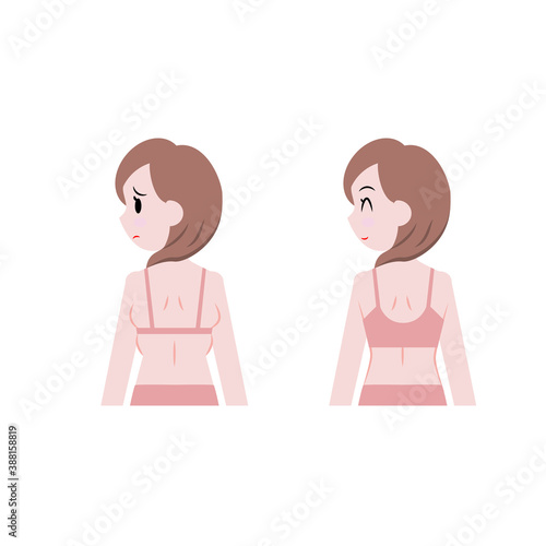 脇肉がはみ出た女性と補正下着