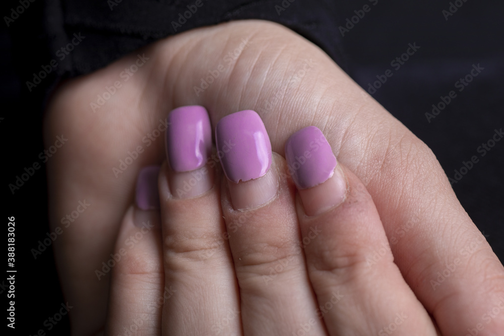 Overgrown gel polish nails manicure. Female hands with overgrown nail Overgrown gel polish nails manicure. Female hands with overgrown nail
