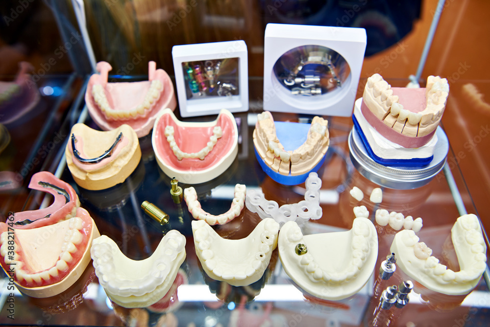Dentures and implants in dental store