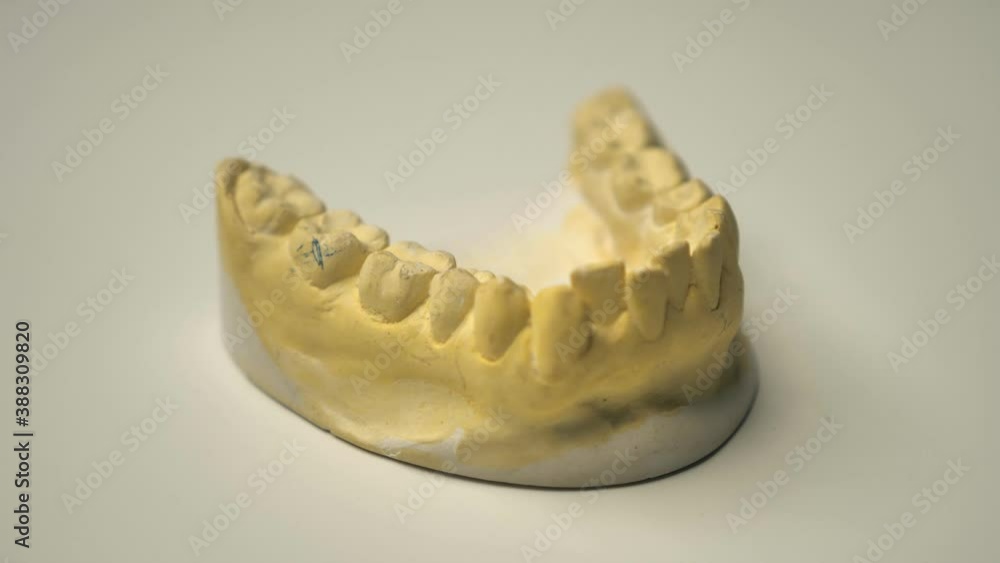 Dental cast of teeth made of plaster for orthodontic treatment. Teeth casts show, they spin on a rotating tray, and the video is looping. Dental cast of teeth made of plaster for orthodontic treatment. Teeth casts show, they spin on a rotating tray, and the video is looping.