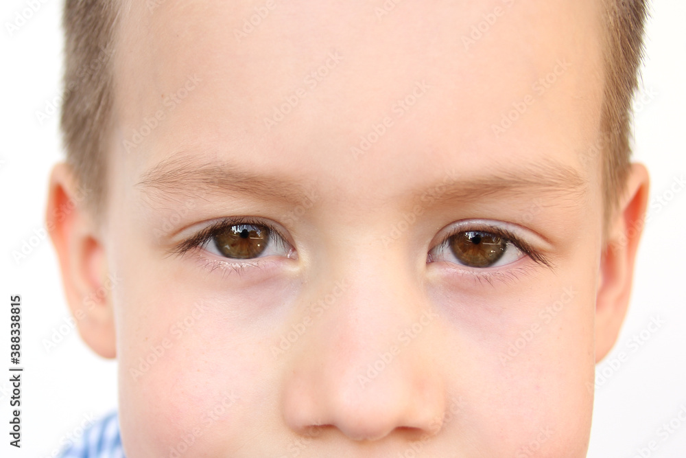 boy, kid, part of the face, funny eyes close up, looking directly, the concept of a happy childhood, diagnosis, treatment of ophthalmic diseases, eyelids, emotional development of children boy, kid, part of the face, funny eyes close up, looking directly, the concept of a happy childhood, diagnosis, treatment of ophthalmic diseases, eyelids, emotional development of children
