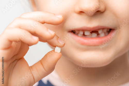 A small child smiles and holds a fallen baby tooth in his hand. Very close-up, soft light