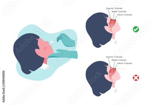 Woman taking Coronavirus (COVID 19) or DNA test by nasal (nose) swab analysis. The right and wrong way nasal swab test. Cartoon flat vector illustration.