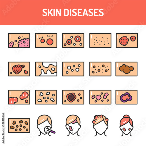 Skin diseases color line icons set. Isolated vector element. Outline pictograms for web page, mobile app, promo