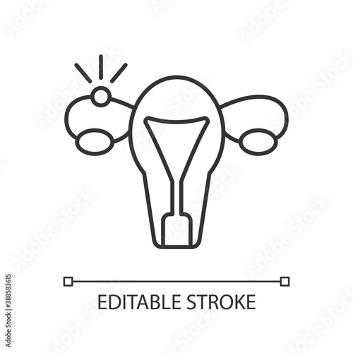 Ectopic pregnancy linear icon. Fallopian tube. Embryo outside uterus. Tubal complication. Thin line customizable illustration. Contour symbol. Vector isolated outline drawing. Editable stroke