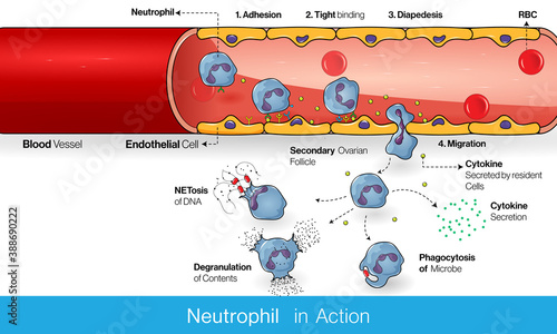Migration of Neutrophils during inflammation through the blood vessel : diapedesis and adhesion vector design