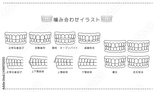 歯科_歯科矯正・歯並び・噛み合わせ白黒