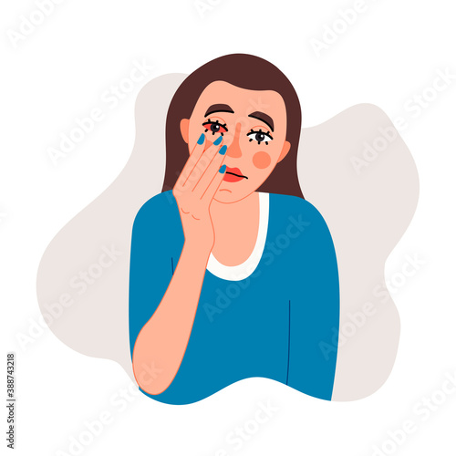 Isolated on white woman suffering from red eye symptom vector illustration. Allergic reaction, stress, lack of sleep  design element. Medical ophthalmic symptom in cartoon style. Eye care.