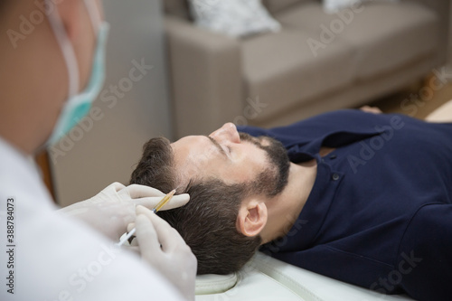 Hair mesotherapy or scalp prp: Platelet-rich plasma procedure. Beautician doctor makes injections in the man head for hair growth to prevent hair loss and baldness
